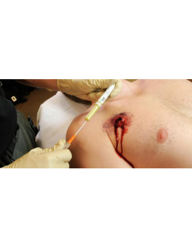 Dekompresinė adata TPAK 14G