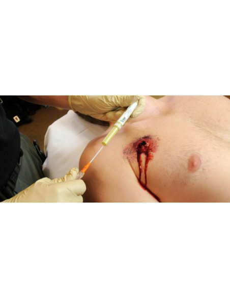 Dekompresinė adata TPAK 14G