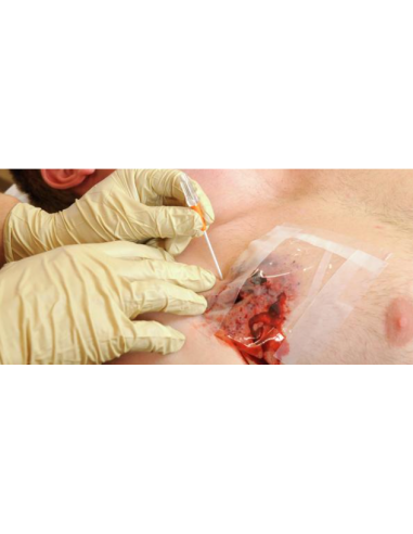 Dekompresinė adata TPAK 14G