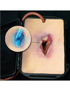 Artilerijos sviedinių skeveldrų padarytų žaizdų simuliatorius SHRAPNEL WOUND IN A BOX™ 2