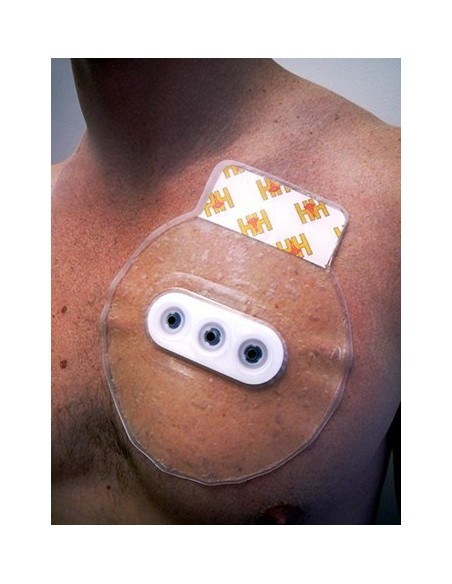 Okliuzinis Krūtinės Žaizdų Tvarstis H&H BOLIN CHEST SEAL