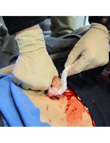 EZ-Gauze wound packing dressing for trauma care