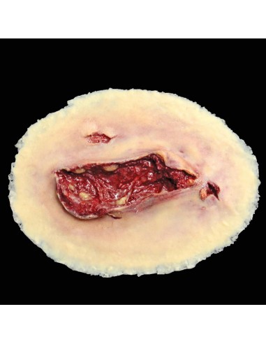 Large laceration wound simulation for medical training