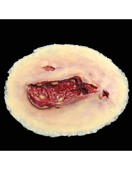 Large laceration wound simulation for medical training