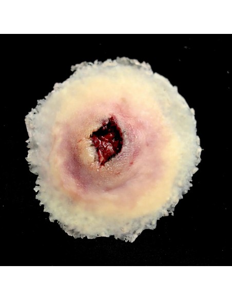 Large gunshot entry wound simulation for medical training
