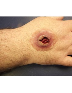 Didelė Šautinės (Įeinančios) Žaizdos Imitacija 2