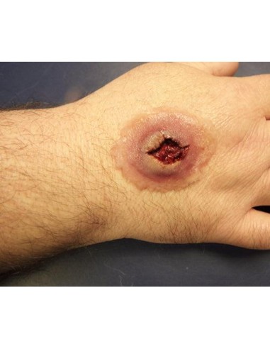 Gunshot entry wound simulator for first aid training