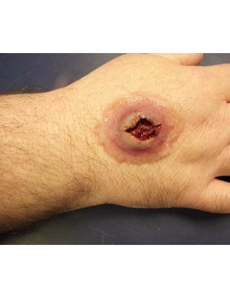 Gunshot entry wound simulator for first aid training
