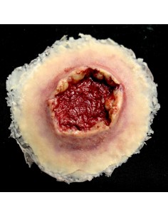 Didelė Šautinės (Išeinančios) Žaizdos Imitacija