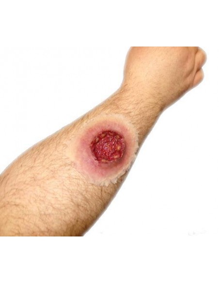 Gunshot exit wound simulator for first aid training