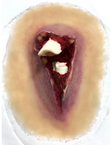 Bone fracture simulator for first aid training