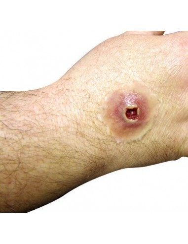 Gunshot entry wound simulator for first aid training