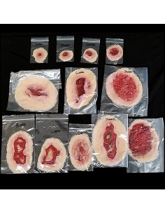 Mažas Lipnių Žaizdų Rinkinys