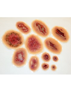 Mažas Lipnių Žaizdų Rinkinys 2