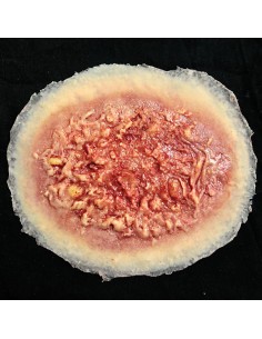 Nudegiminė 2-Ojo Laipsnio Žaizdos Imitacija