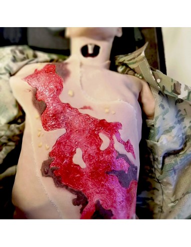 Thermal burn third degree chest wound model