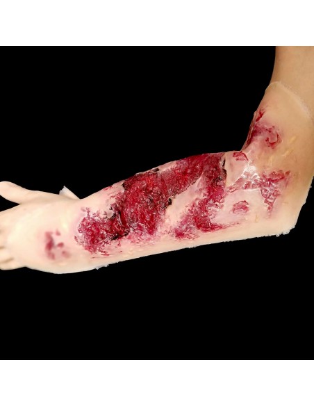 Third degree hand burn simulation for medical training