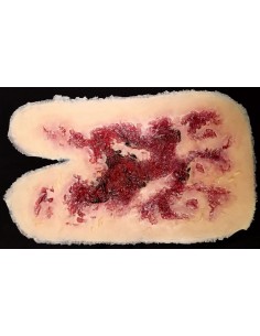 Terminė 3-Iojo Laipsnio Rankos Nudegimo Imitacija 2