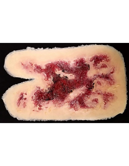 Thermal burn third degree wound model for hand injury