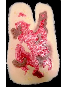 Terminė 3-Iojo Laipsnio Rankos Nudegimo Imitacija (Pašalinta) 2