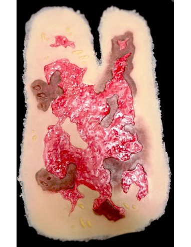 Thermal burn third degree wound model for hand injury
