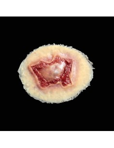 Vidutinė Cheminio Nudegimo Žaizdos Imitacija