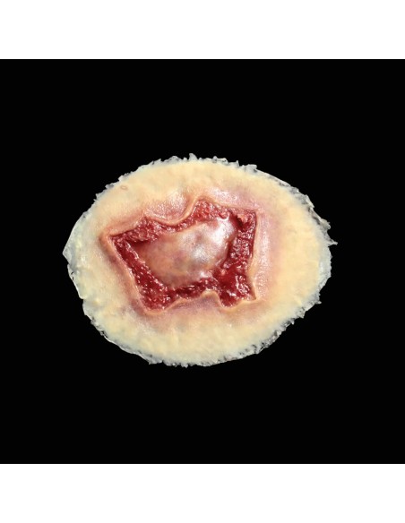 Medium chemical burn wound simulation for medical training