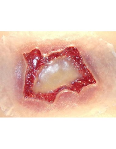 Chemical burn injury simulator for first aid training