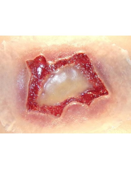 Chemical burn injury simulator for first aid training