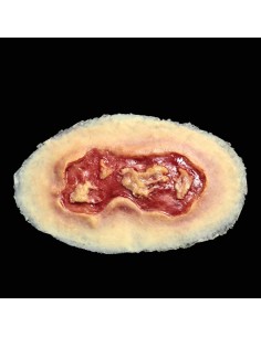 Vidutinė elektros nudegimo žaizdos imitacija medicinos mokymams