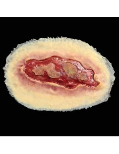 Didelė elektros nudegimo žaizdos imitacija medicinos mokymams
