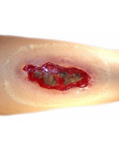 Didelė elektros nudegimo žaizdos imitacija medicinos mokymams 2