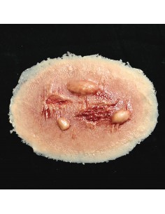 Vidutinė terminio nudegimo imitacija medicinos mokymams ir simuliacijoms