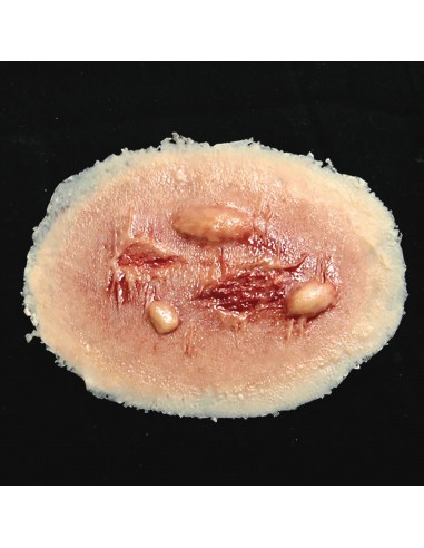 Vidutinė Terminio Nudegimo Imitacija