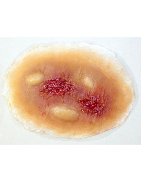 Vidutinė Terminio Nudegimo Imitacija