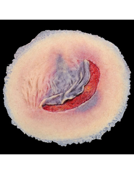 Skin Tear - Techline Technologies