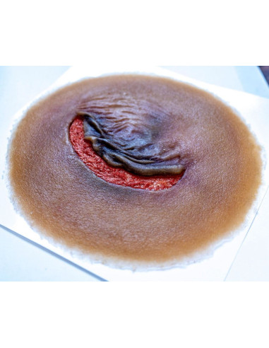 Skin Tear - Techline Technologies