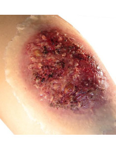 Didelė Terminio nudegimo imitacija 2